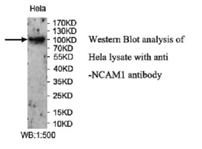 Anti-NCAM1