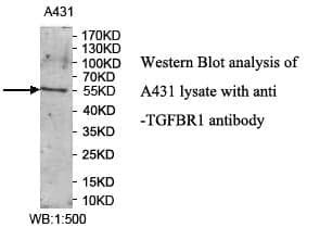 Anti-TGFBR1
