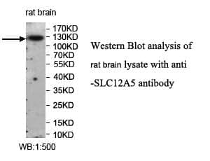 Anti-SLC12A5