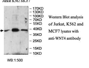 Anti-WNT4