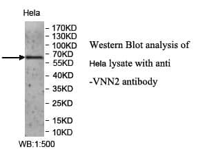 Anti-VNN2