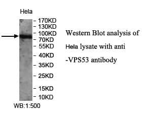 Anti-VPS53