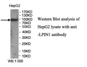 Anti-LPIN1