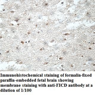 Anti-FICD