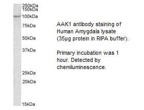 Anti-AAK1