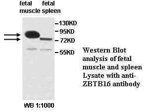 Anti-ZBTB16