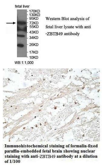 Anti-ZBTB49