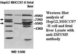 Anti-ZMYM5