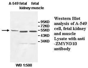 Anti-ZMYND10