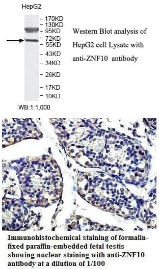 Anti-ZNF10