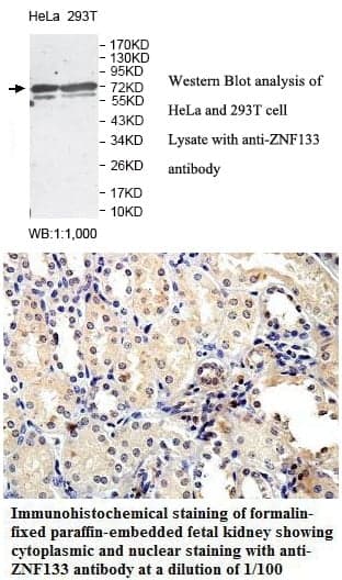 Anti-ZNF133