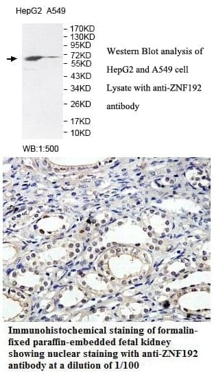 Anti-ZNF192