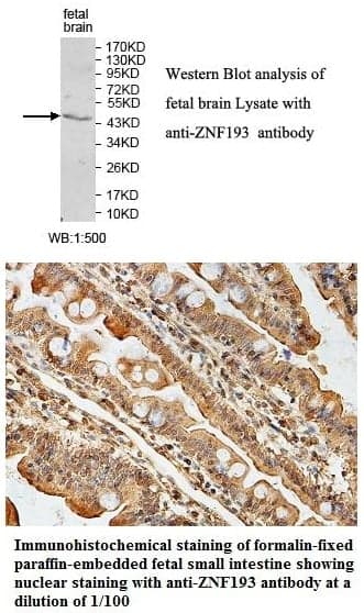 Anti-ZNF193