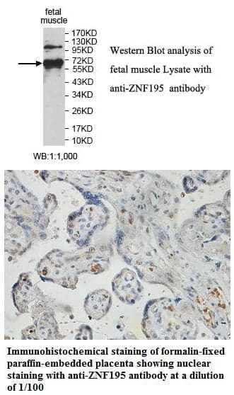 Anti-ZNF195