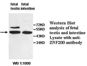 Anti-ZNF200