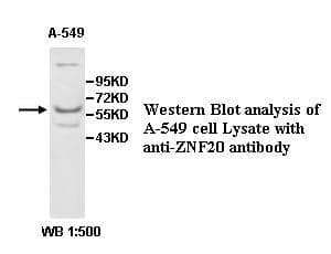 Anti-ZNF20
