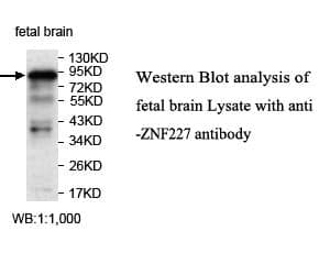 Anti-ZNF227
