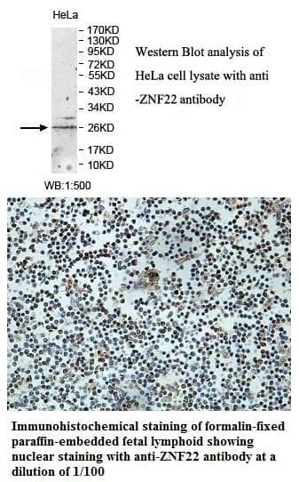 Anti-ZNF22