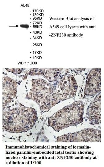 Anti-ZNF230