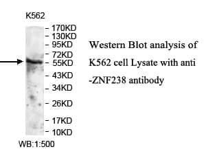 Anti-ZNF238
