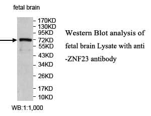Anti-ZNF23