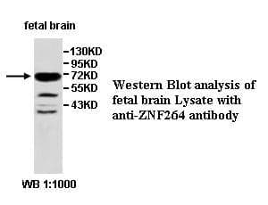 Anti-ZNF264