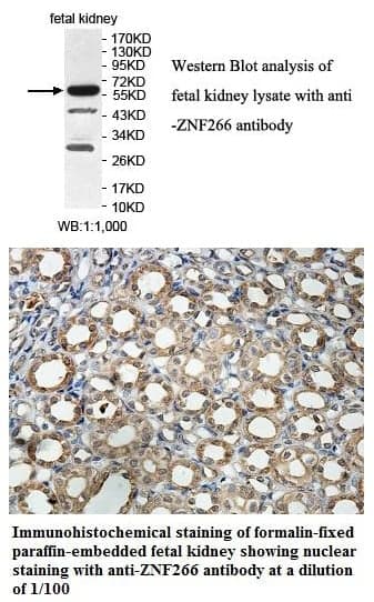 Anti-ZNF266