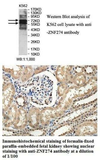 Anti-ZNF274