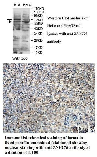 Anti-ZNF276