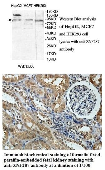 Anti-ZNF287