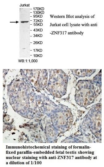Anti-ZNF317