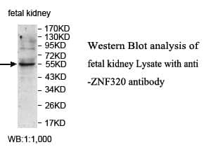 Anti-ZNF320