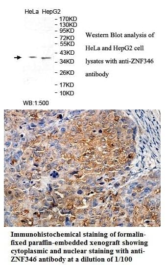 Anti-ZNF346
