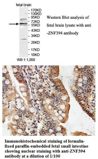 Anti-ZNF394