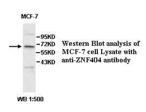 Anti-ZNF404