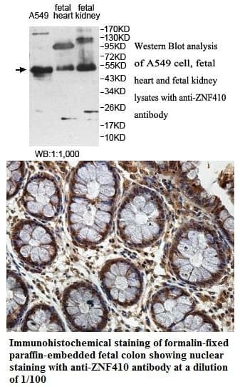 Anti-ZNF410