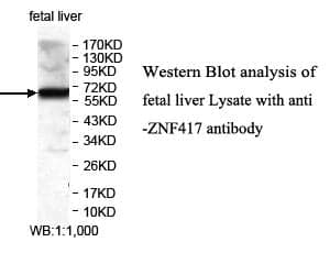 Anti-ZNF417
