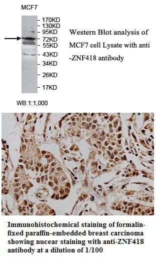 Anti-ZNF418