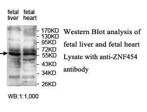 Anti-ZNF454