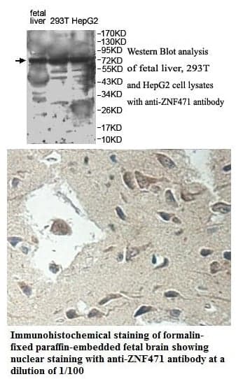 Anti-ZNF471