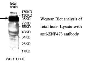 Anti-ZNF473