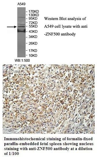 Anti-ZNF500