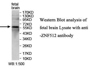 Anti-ZNF512