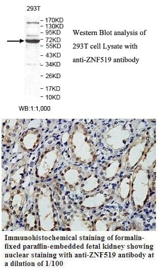 Anti-ZNF519