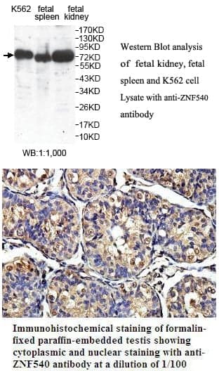 Anti-ZNF540