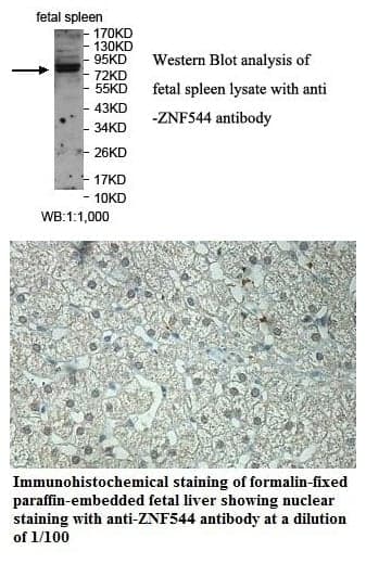 Anti-ZNF544