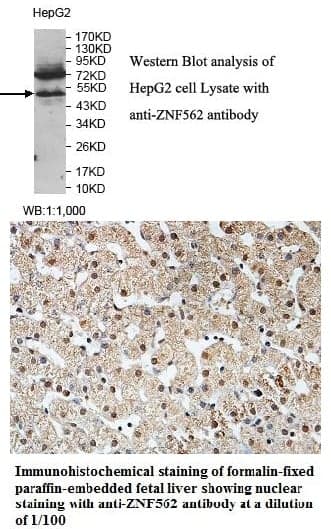 Anti-ZNF562