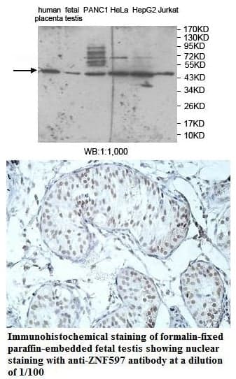 Anti-ZNF597