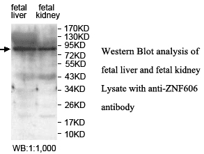 Anti-ZNF606