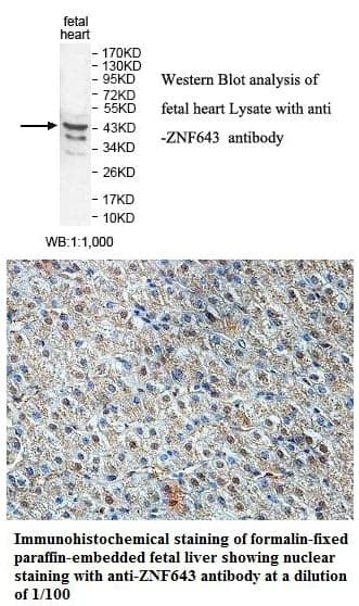 Anti-ZNF643